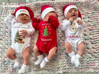 Vo Fakultnej nemocnici AGEL Košice-Šaca sa v roku 2025 narodilo až 20 dvojičiek